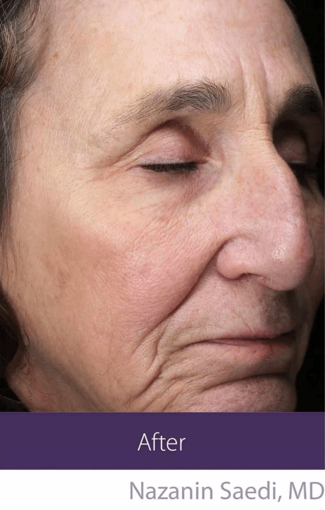 After Image: Fractional Plasma - right-front-oblique