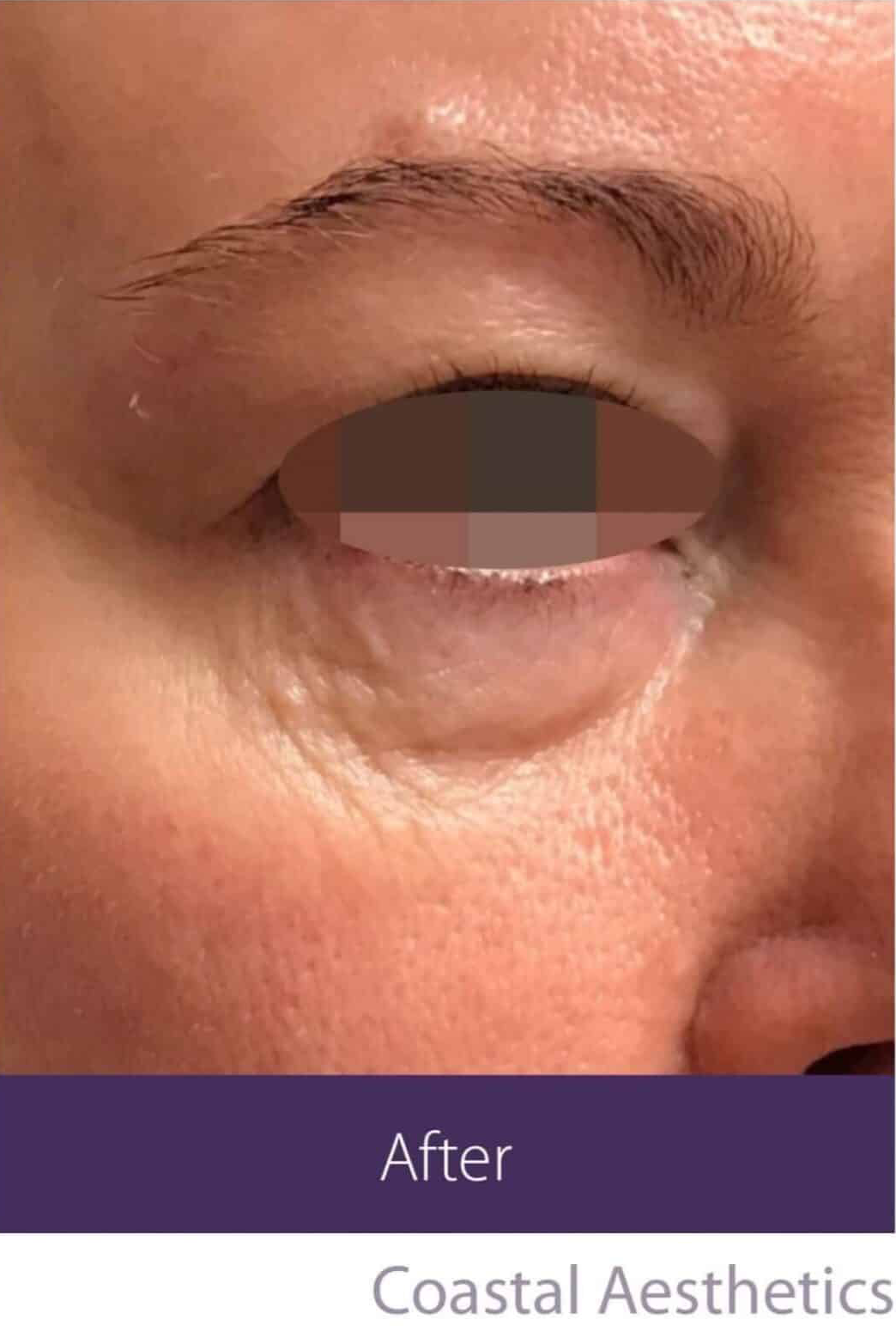 After Image: Fractional Plasma - right-front-oblique